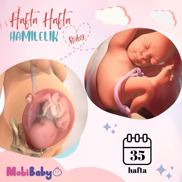 35 Haftalık Hamilelik