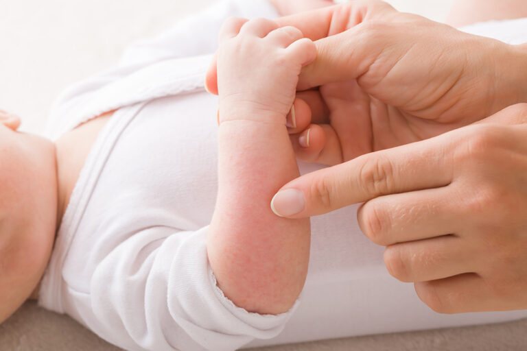 Bebeklere Nasıl Cilt Bakımı Yapılmalıdır?